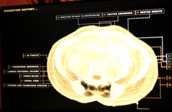 Midjourney, The AI Image Generator, Is Developing A Full-Body Ultrasonic Scanner